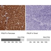 Anti-PNLIP antibody produced in rabbit Prestige Antibodies® Powered by Atlas Antibodies, affinity isolated antibody, buffered aqueous glycerol solution
