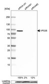 Anti-VPS35 antibody produced in rabbit Prestige Antibodies&#174; Powered by Atlas Antibodies, affinity isolated antibody, buffered aqueous glycerol solution