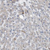 Anti-GC antibody produced in rabbit Prestige Antibodies&#174; Powered by Atlas Antibodies, affinity isolated antibody, buffered aqueous glycerol solution