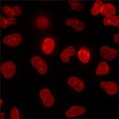 A549 Cells GFP-CTNNB1 RFP-LMNB1