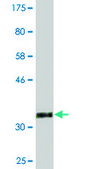 Monoclonal Anti-TMOD3, (C-terminal) antibody produced in mouse clone 1E1, purified immunoglobulin, buffered aqueous solution