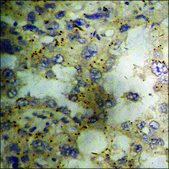 Anti-phospho-PLB (pSer16+Thr17) antibody produced in rabbit affinity isolated antibody