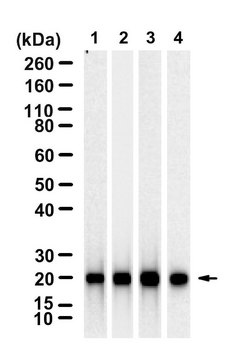 Anti-CBX3/HP1&#947; Antibody, clone 1K5 ZooMAb&#174; Rabbit Monoclonal recombinant, expressed in HEK 293 cells
