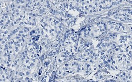 Anti-GATA-3 Antibody, clone 1B11 ZooMAb&#174; Rabbit Monoclonal recombinant, expressed in HEK 293 cells