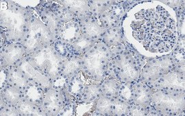 Anti-STK3 Antibody, clone 1H12 ZooMAb&#174; Rabbit Monoclonal recombinant, expressed in HEK 293 cells