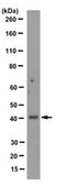 Anti-Epithelial Specific Antigen Antibody, clone VU-1D9 clone VU-1D9, from mouse