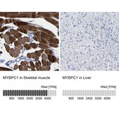 Anti-MYBPC1 antibody produced in rabbit Prestige Antibodies&#174; Powered by Atlas Antibodies, affinity isolated antibody, buffered aqueous glycerol solution