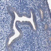 Anti-WIPI2 antibody produced in rabbit Prestige Antibodies&#174; Powered by Atlas Antibodies, affinity isolated antibody, buffered aqueous glycerol solution, Ab2