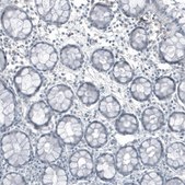 Monoclonal Anti-FRMD5 antibody produced in mouse Prestige Antibodies&#174; Powered by Atlas Antibodies, clone CL9503, purified immunoglobulin, buffered aqueous glycerol solution