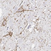 Anti-CALCR antibody produced in rabbit Prestige Antibodies&#174; Powered by Atlas Antibodies, affinity isolated antibody, buffered aqueous glycerol solution