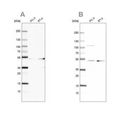 Anti-UQCRC1 antibody produced in rabbit Ab1, Prestige Antibodies&#174; Powered by Atlas Antibodies, affinity isolated antibody, buffered aqueous glycerol solution