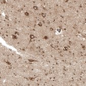 Anti-PREX1 antibody produced in rabbit Prestige Antibodies&#174; Powered by Atlas Antibodies, affinity isolated antibody, buffered aqueous glycerol solution