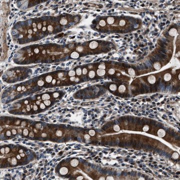 Anti-WDR60 antibody produced in rabbit Prestige Antibodies&#174; Powered by Atlas Antibodies, affinity isolated antibody, buffered aqueous glycerol solution, Ab1