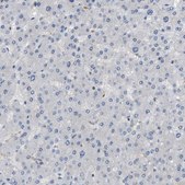 Anti-CSTB antibody produced in rabbit Prestige Antibodies&#174; Powered by Atlas Antibodies, affinity isolated antibody, buffered aqueous glycerol solution