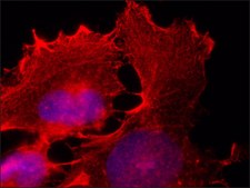 Anti-E6AP antibody, Mouse monoclonal clone E6AP-330, purified from hybridoma cell culture