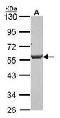 Anti-DKK3 antibody produced in rabbit affinity isolated antibody, buffered aqueous solution