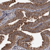 Anti-CDK5RAP3 antibody produced in rabbit Prestige Antibodies&#174; Powered by Atlas Antibodies, affinity isolated antibody, buffered aqueous glycerol solution