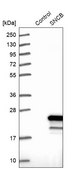 Anti-SNCB antibody produced in rabbit Prestige Antibodies&#174; Powered by Atlas Antibodies, affinity isolated antibody, buffered aqueous glycerol solution