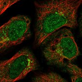 Anti-GCC2 antibody produced in rabbit Prestige Antibodies&#174; Powered by Atlas Antibodies, affinity isolated antibody, buffered aqueous glycerol solution