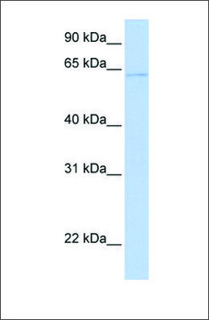 Anti-PPAT antibody produced in rabbit affinity isolated antibody