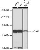 Anti-Radixin Antibody, clone 4U6W9, Rabbit Monoclonal