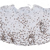 Monoclonal Anti-SETD2 antibody produced in mouse Prestige Antibodies&#174; Powered by Atlas Antibodies, clone CL9956, purified immunoglobulin, buffered aqueous glycerol solution