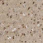 Anti-VAPB antibody produced in rabbit Prestige Antibodies&#174; Powered by Atlas Antibodies, affinity isolated antibody, buffered aqueous glycerol solution