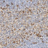 Anti-IL18 antibody produced in rabbit Prestige Antibodies&#174; Powered by Atlas Antibodies, affinity isolated antibody, buffered aqueous glycerol solution