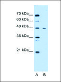 Anti-ENO3 (AB1) antibody produced in rabbit affinity isolated antibody