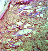 Monoclonal Anti-Collagen, Type III antibody produced in mouse clone FH-7A, ascites fluid