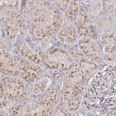 Anti-SH3BP5 antibody produced in rabbit Prestige Antibodies&#174; Powered by Atlas Antibodies, affinity isolated antibody, buffered aqueous glycerol solution