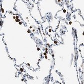 Anti-NCF2 antibody produced in rabbit Prestige Antibodies&#174; Powered by Atlas Antibodies, affinity isolated antibody, buffered aqueous glycerol solution