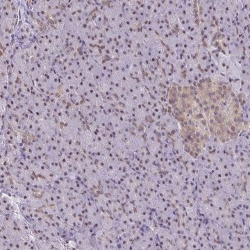 Anti-ING4 antibody produced in rabbit Prestige Antibodies&#174; Powered by Atlas Antibodies, affinity isolated antibody, buffered aqueous glycerol solution