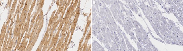 Anti-GLUT-4 Antibody, C-terminus from rabbit, purified by affinity chromatography