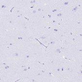 Anti-BPI antibody produced in rabbit Prestige Antibodies&#174; Powered by Atlas Antibodies, affinity isolated antibody, buffered aqueous glycerol solution