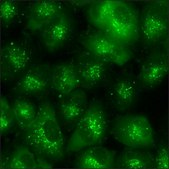 A549 Cells GFP-STAT1