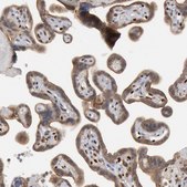 Anti-FOXO1 antibody produced in rabbit Prestige Antibodies&#174; Powered by Atlas Antibodies, affinity isolated antibody, buffered aqueous glycerol solution