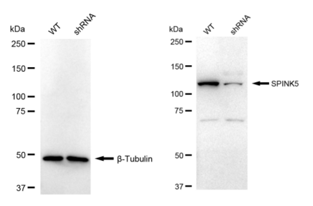 KD-Validated Anti SPINK5 Antibody, clone 23GB4180, Rabbit Monoclonal clone 23GB4180, recombinant rabbit monoclonal, expressed in HEK293 cells