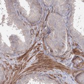 Anti-SH3PXD2A antibody produced in rabbit Prestige Antibodies&#174; Powered by Atlas Antibodies, affinity isolated antibody, buffered aqueous glycerol solution