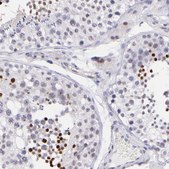 Anti-SOX6 antibody produced in rabbit Prestige Antibodies&#174; Powered by Atlas Antibodies, affinity isolated antibody, buffered aqueous glycerol solution