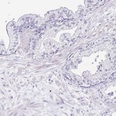 Anti-SRL antibody produced in rabbit Prestige Antibodies&#174; Powered by Atlas Antibodies, affinity isolated antibody, buffered aqueous glycerol solution