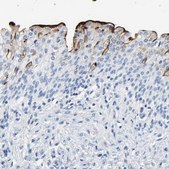 Anti-UPK3A antibody produced in rabbit Prestige Antibodies&#174; Powered by Atlas Antibodies, affinity isolated antibody, buffered aqueous glycerol solution, Ab2