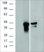 Anti-Aurora Kinase A/AURKA antibody produced in goat affinity isolated antibody, buffered aqueous solution