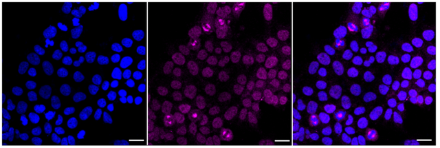 KD-Validated Anti Carbonic anhydrase II Antibody, clone 23GB3300, Rabbit Monoclonal clone 23GB3300, recombinant rabbit monoclonal, expressed in HEK293 cells