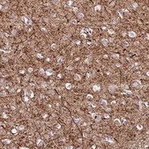 Anti-C2CD3 antibody produced in rabbit Prestige Antibodies&#174; Powered by Atlas Antibodies, affinity isolated antibody, buffered aqueous glycerol solution