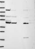 Anti-TIMM44 antibody produced in rabbit Prestige Antibodies&#174; Powered by Atlas Antibodies, affinity isolated antibody, buffered aqueous glycerol solution