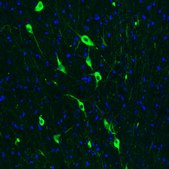 Monoclonal Anti-CHAT antibody produced in mouse Prestige Antibodies® Powered by Atlas Antibodies, clone CL3173, purified immunoglobulin, buffered aqueous glycerol solution