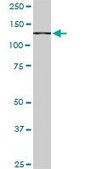 Monoclonal Anti-CAND1 antibody produced in mouse clone 1G5, purified immunoglobulin, buffered aqueous solution