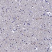 Anti-NPY antibody produced in rabbit Prestige Antibodies&#174; Powered by Atlas Antibodies, affinity isolated antibody, buffered aqueous glycerol solution