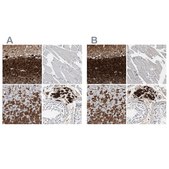 Anti-CALB2 antibody produced in rabbit Prestige Antibodies&#174; Powered by Atlas Antibodies, affinity isolated antibody, buffered aqueous glycerol solution